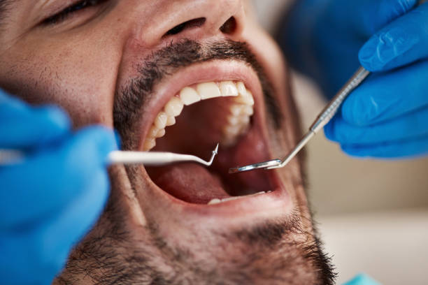 Best Emergency Dental Care for Abscessed Tooth in Towson, MD